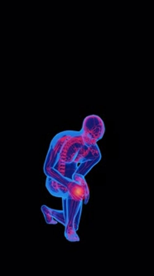 3D Animated Human Skeleton with Knee Joint Pain