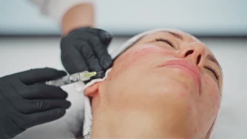 Woman Receiving Facial Injection in Clinic, Close Up