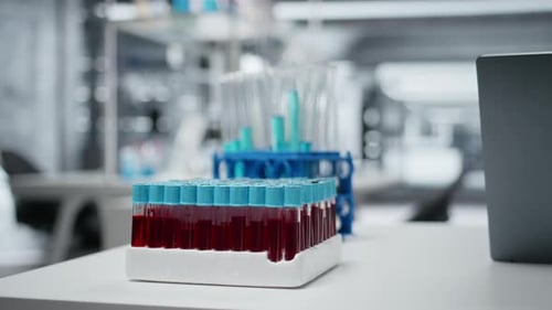 Close Up of Small Glass Flasks Containing Red Blood Samples on Lab Workbench