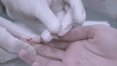 Nurse taking blood sample for hiv test from male patient's finger in clinic