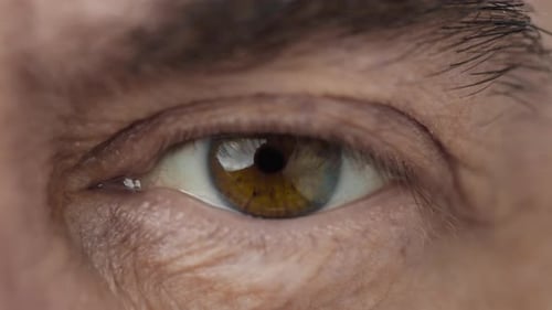 Amber Eye Opening Macro Shot