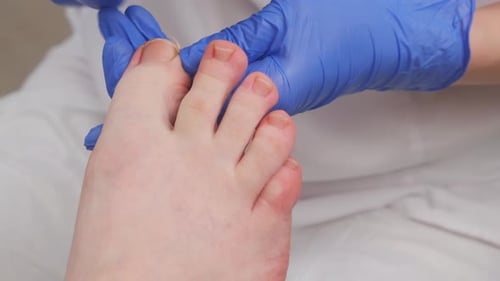 Foot Toenail Clipping in Hospital Setting