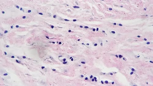 Teased Human Tendon in Cross Section Magnified Under Microscope in 400 Times on Bright Field