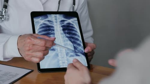 Doctor Explains Chest X-Ray on Tablet