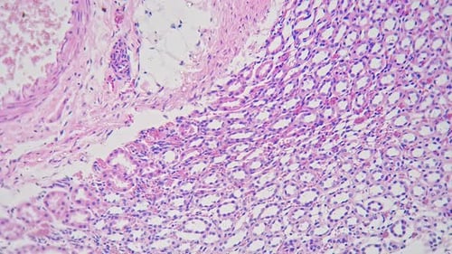 Section of Artery and Vein Under Microscope with 200 Times Magnification Filmed on Bright Field