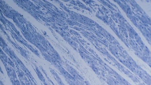 Cardiac muscle