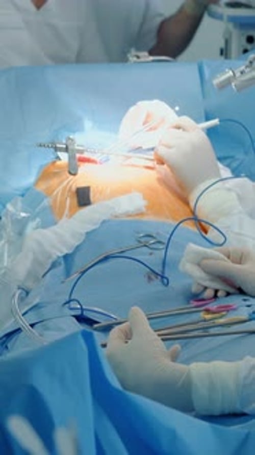 Das Chirurgenteam führt eine Herzoperation in der Klinik durch