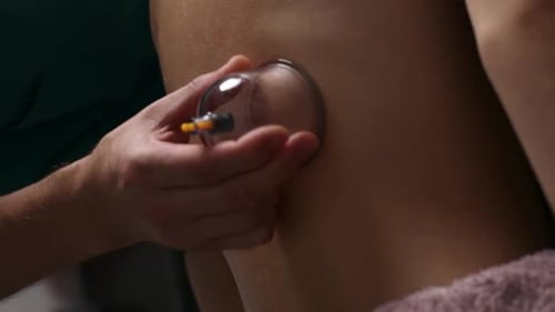 Massage Therapist Doing Back Vacuum Massage With Cups In Spa