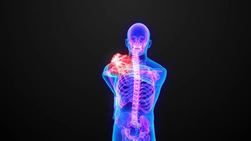 3D Human Anatomy Animation of Shoulder, Neck, and Back Pain