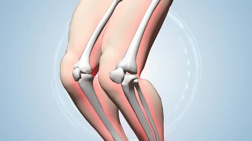 3D Animation of Human Knee Joint Healing Process