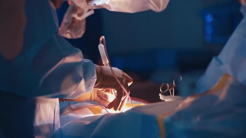 Close-up shoot of operating process in clinic.