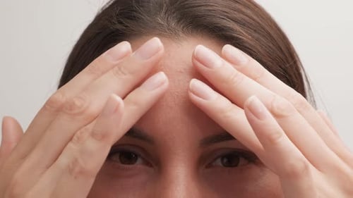Woman Touches Her Forehead with Her Hands The Forehead is Peeling Dry Skin