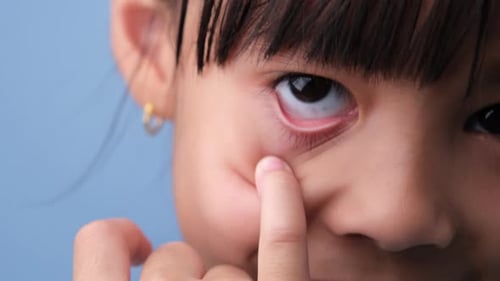 Close-up part child's face, eyes girl. Beautiful little girl with funny face and fingers open her ey
