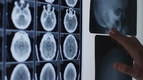 Überprüfung von Gehirnscans