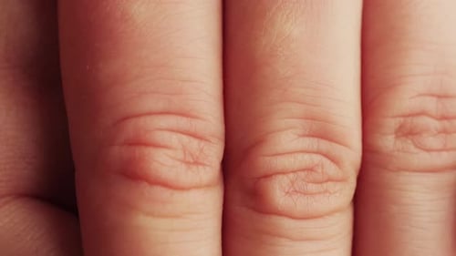 Hand Fingers Closeup Hand Skin Texture