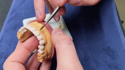 Artificial Teeth Crafted with Precision in Dental Lab