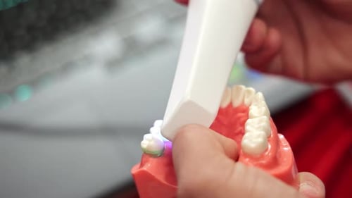 Dental Intraoral Scanner in Action Tooth Model Being Digitally Captured in Clinic