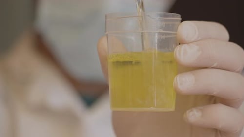 Doctor prepares a urine specimen for analysis. Closeup view