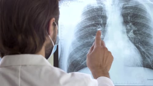 Man in Coat Examining Lung X-Ray