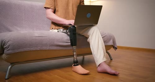 Person with Prosthetic Leg Uses Laptop on Couch