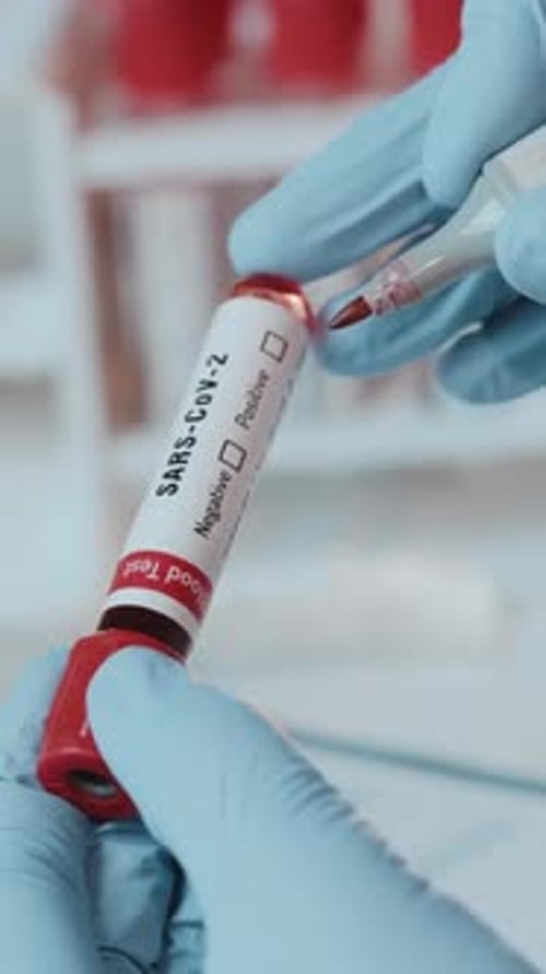 Marking Blood Test Positive for SARS-CoV-2