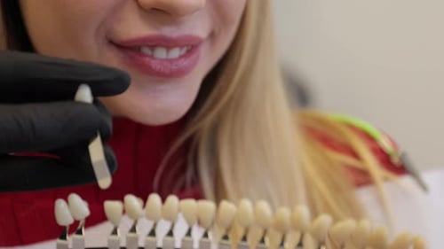 Woman smiles during teeth whitening process at dentist