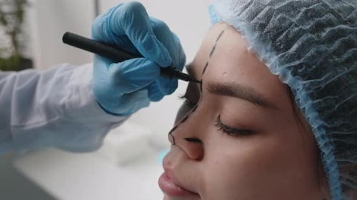 Hands of Plastic Surgeon Marking Nose and Forehead of Female Patient