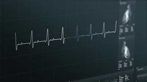 Heartbeat Monitor Showing Regular Electrocardiogram Line On Screen