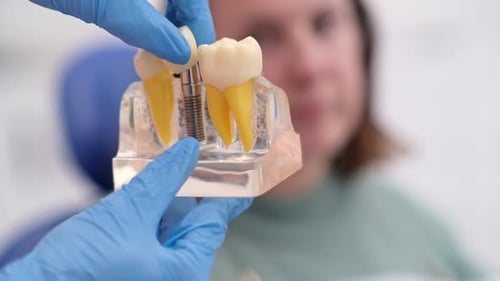 Gloved Hands Assembling a Tooth Implant Model