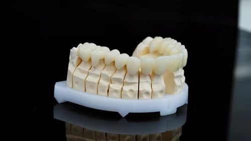 Dental Veneer and Crown Model on Black Background