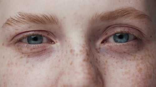 Extreme Close Up of Freckled Face Blinking