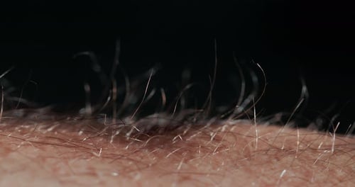 Hair on the Skin of Men Rise Due to Strong Excitement and Stress