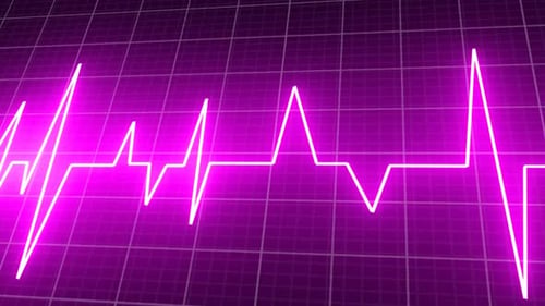 Heartbeat
