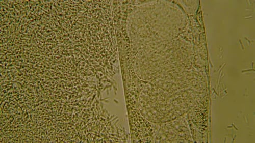 Dynamic Microscopic Organisms Under a Microscope