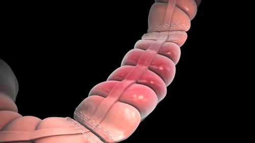 Inflamed colon with surgical staples on a black background