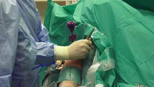 Surgical Operation by Surgeons in Operating Room