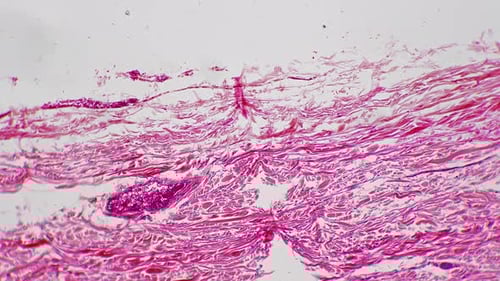 Human Tissue Sample Under Microscope