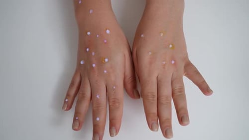 Top View Female Palms Turning to Hands with Monkey Pox Rash in Slow Motion