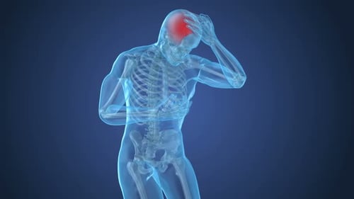 Head pain Attack, man suffering from brain pain. 3D animation