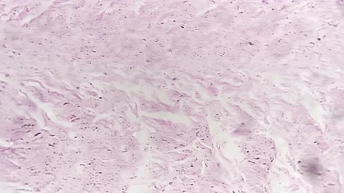 Close Up of Bodily Tissue Under a Microscope