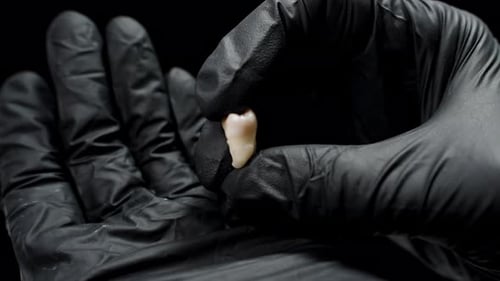 Extracted Molar Tooth Held in Black Gloves