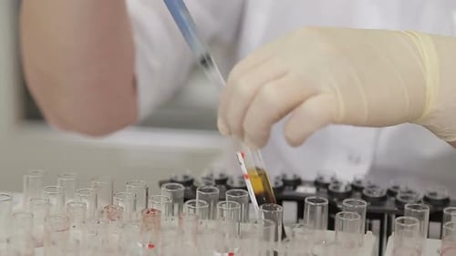 Lab Technician Examines the Blood and Urine