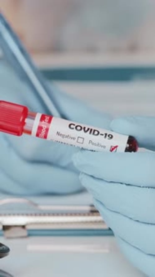 COVID-19 Test Tube Positive Result