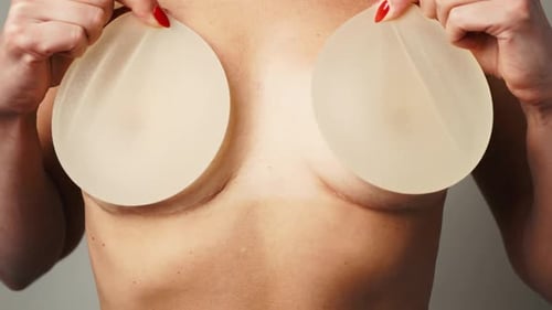 Woman Holding Silicone Breast Implants for Surgery