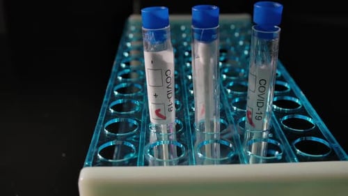 COVID-19 Test Tubes in Lab Rack
