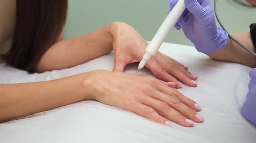 Dermatologist Using Needle Device on Hand for Treatment