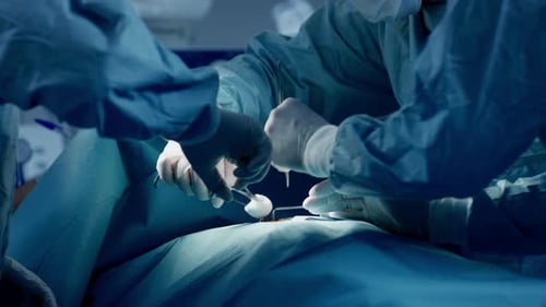 Diverse Team of Professional Surgeons Performing Invasive Surgery on a Patient in the Hospital Oper