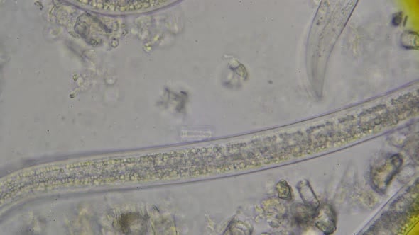 Roundworms nematodes, Steinernema, under the microscope at 600 times ...