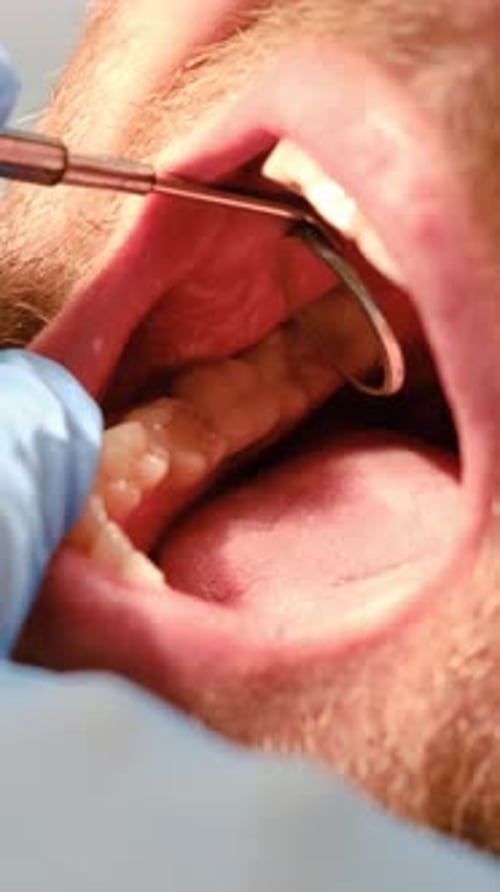 Inside Mouth with Dental Mirror Close Up