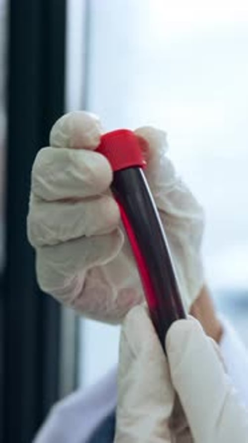 Medical Professional Holding Test Tube with Blood Sample